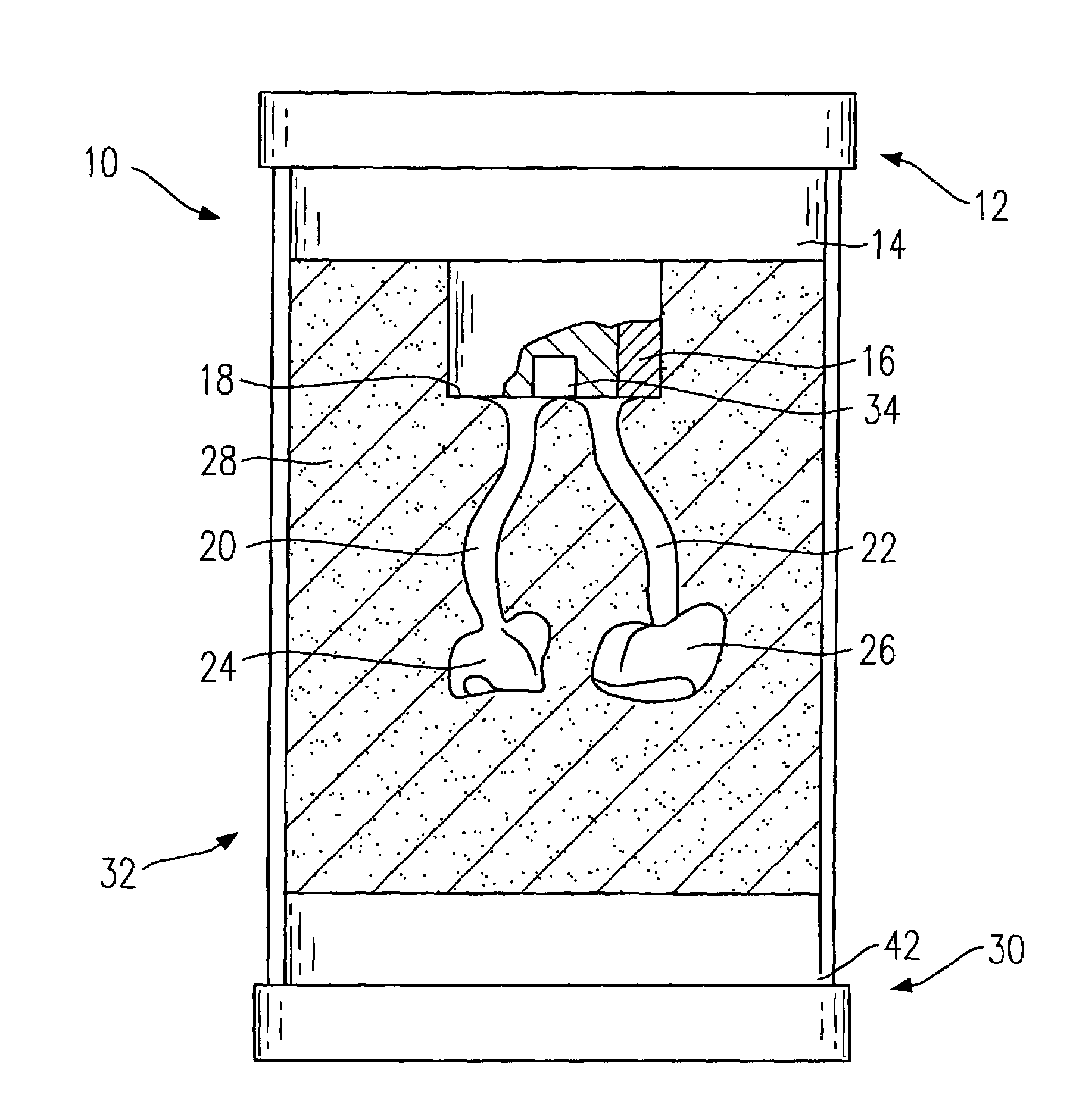 Retort system