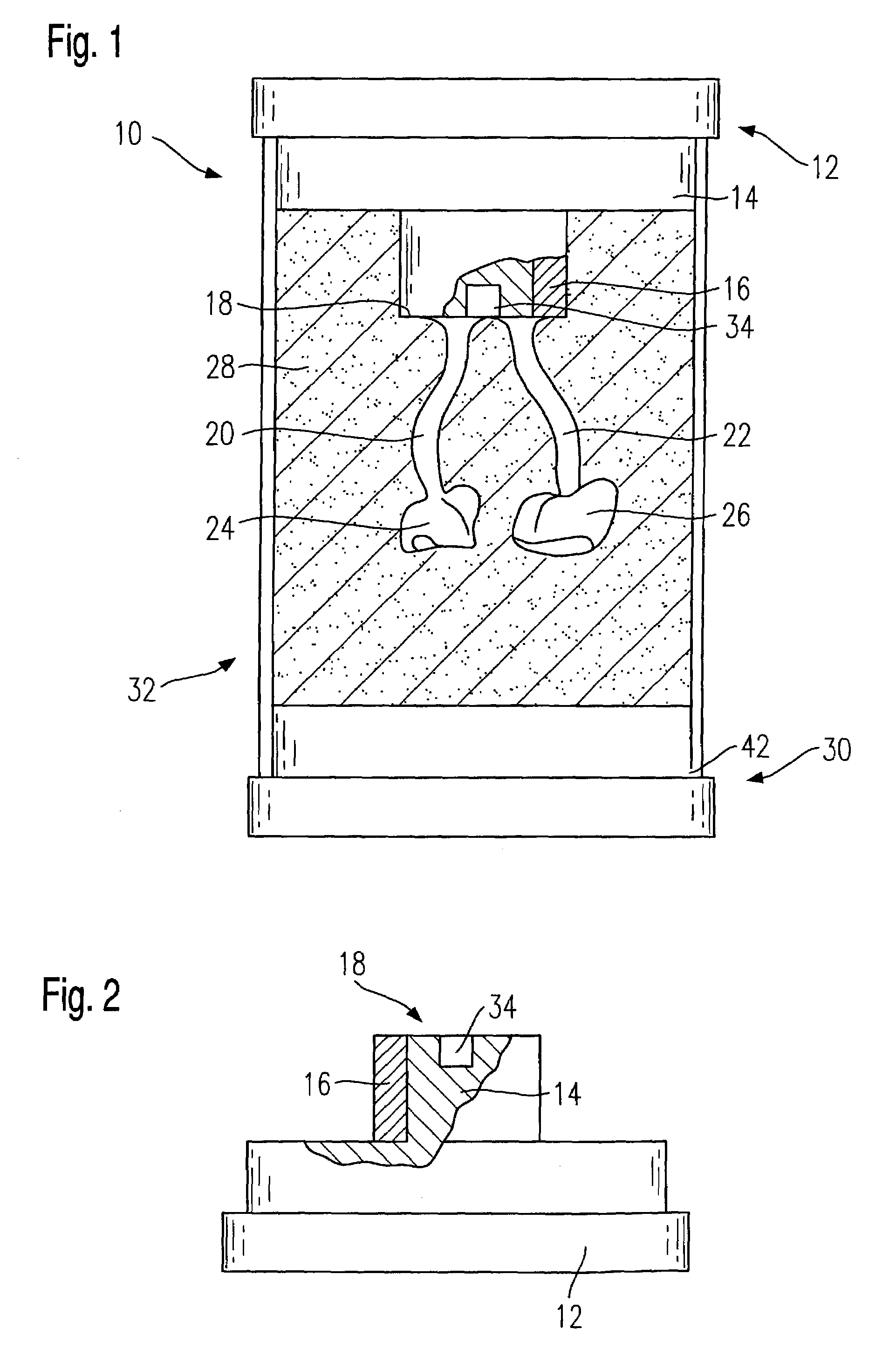 Retort system