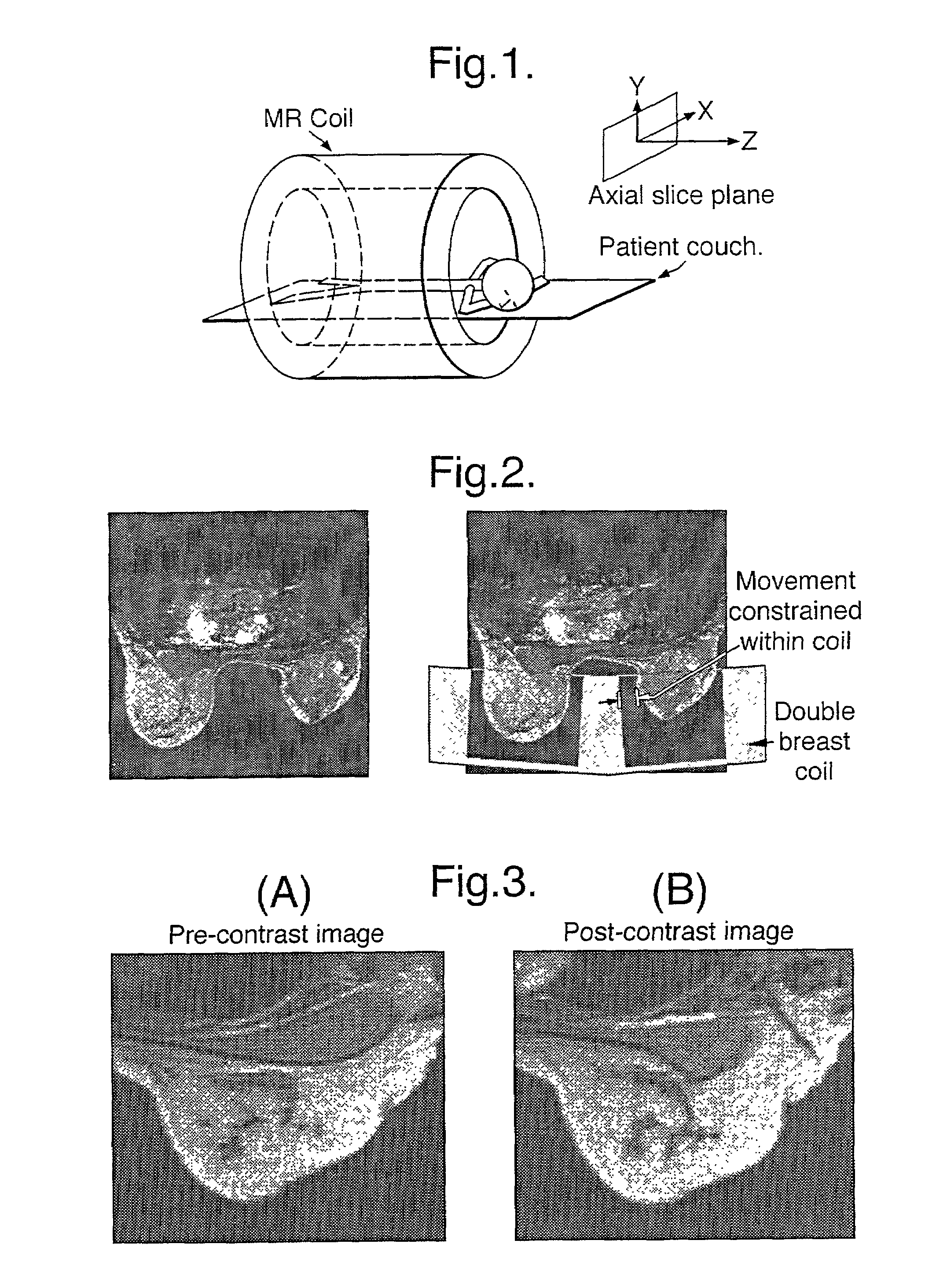 Method and apparatus for image processing