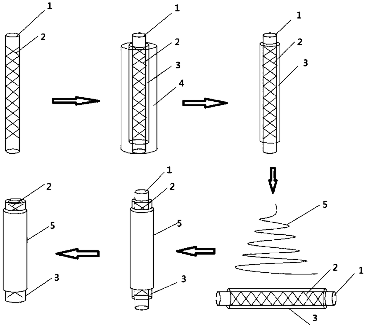 Small-caliber bionic blood vessel with three-layer structure and manufacturing method thereof