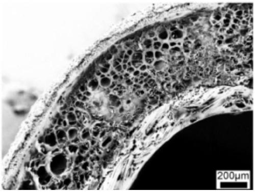 Small-caliber bionic blood vessel with three-layer structure and manufacturing method thereof