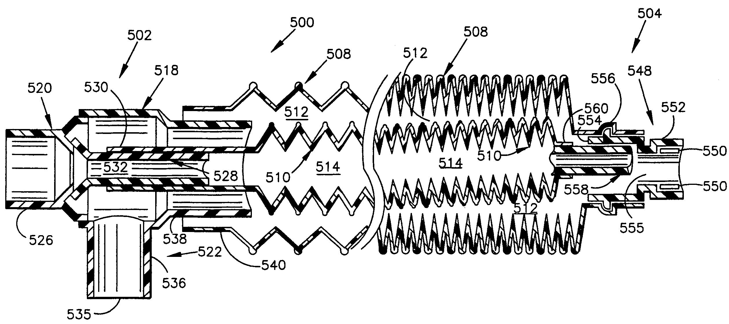 Adjustable length breathing circuit