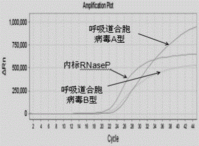 Nucleic acid detection kit for rapidly detecting respiratory syncytial viruses A and B and application of nucleic acid detection kit