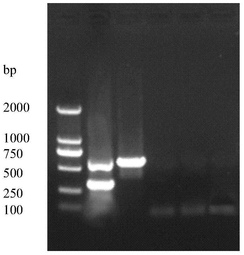 Primers for differential diagnosis of porcine epidemic diarrhea virus virulent strain and attenuated strain and detection kit thereof