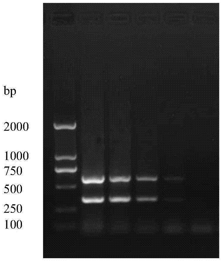 Primers for differential diagnosis of porcine epidemic diarrhea virus virulent strain and attenuated strain and detection kit thereof