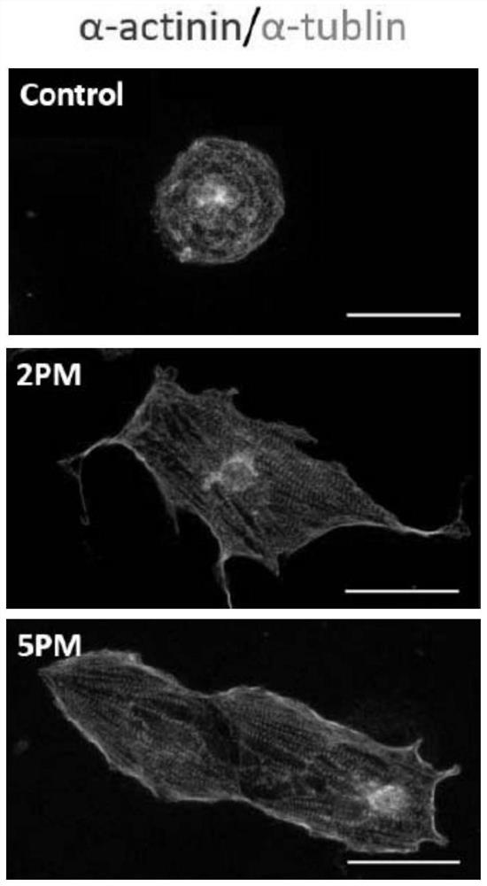 Cardiomyocyte preparation method