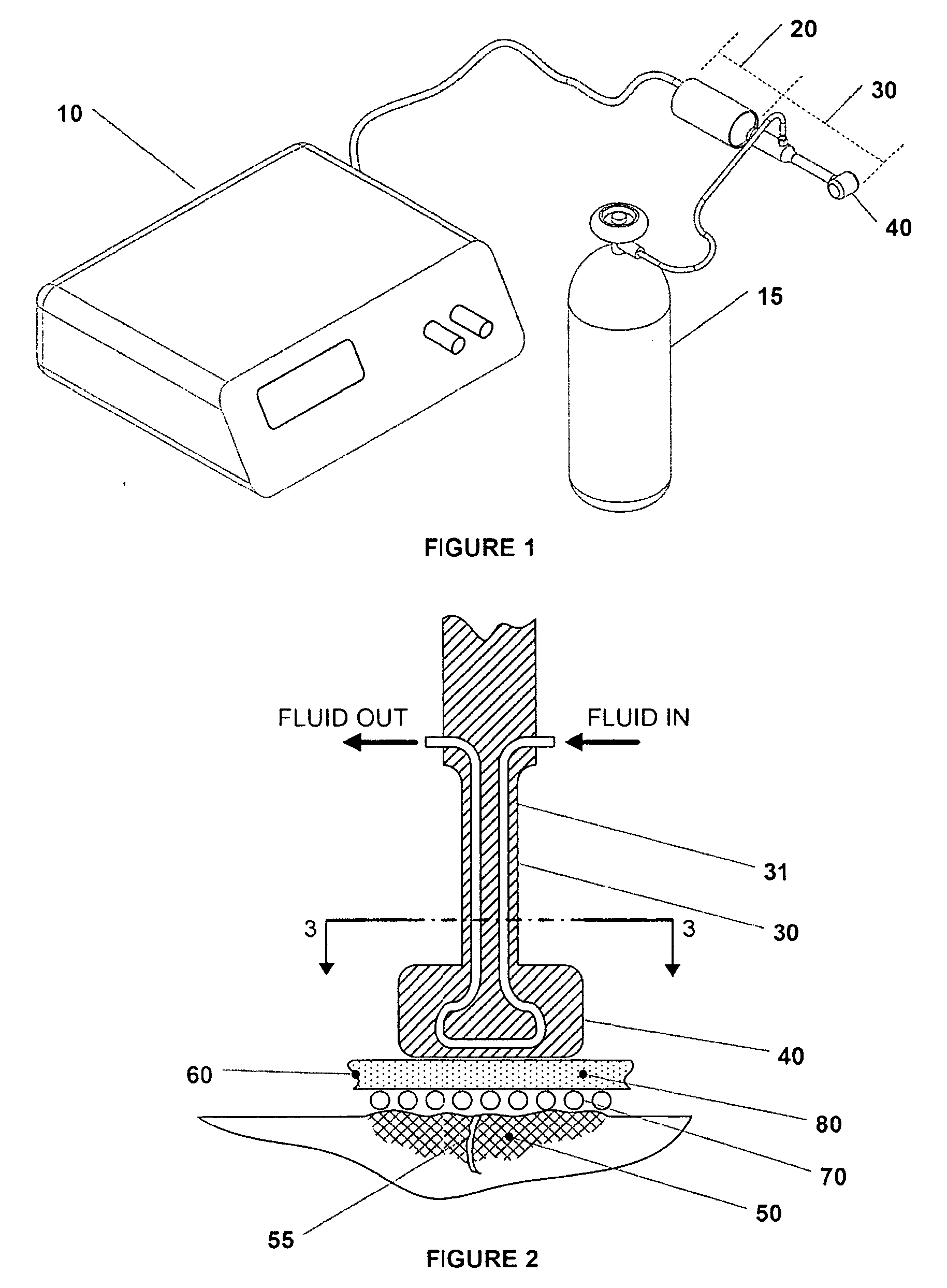 Ultrasound assisted tissue welding method