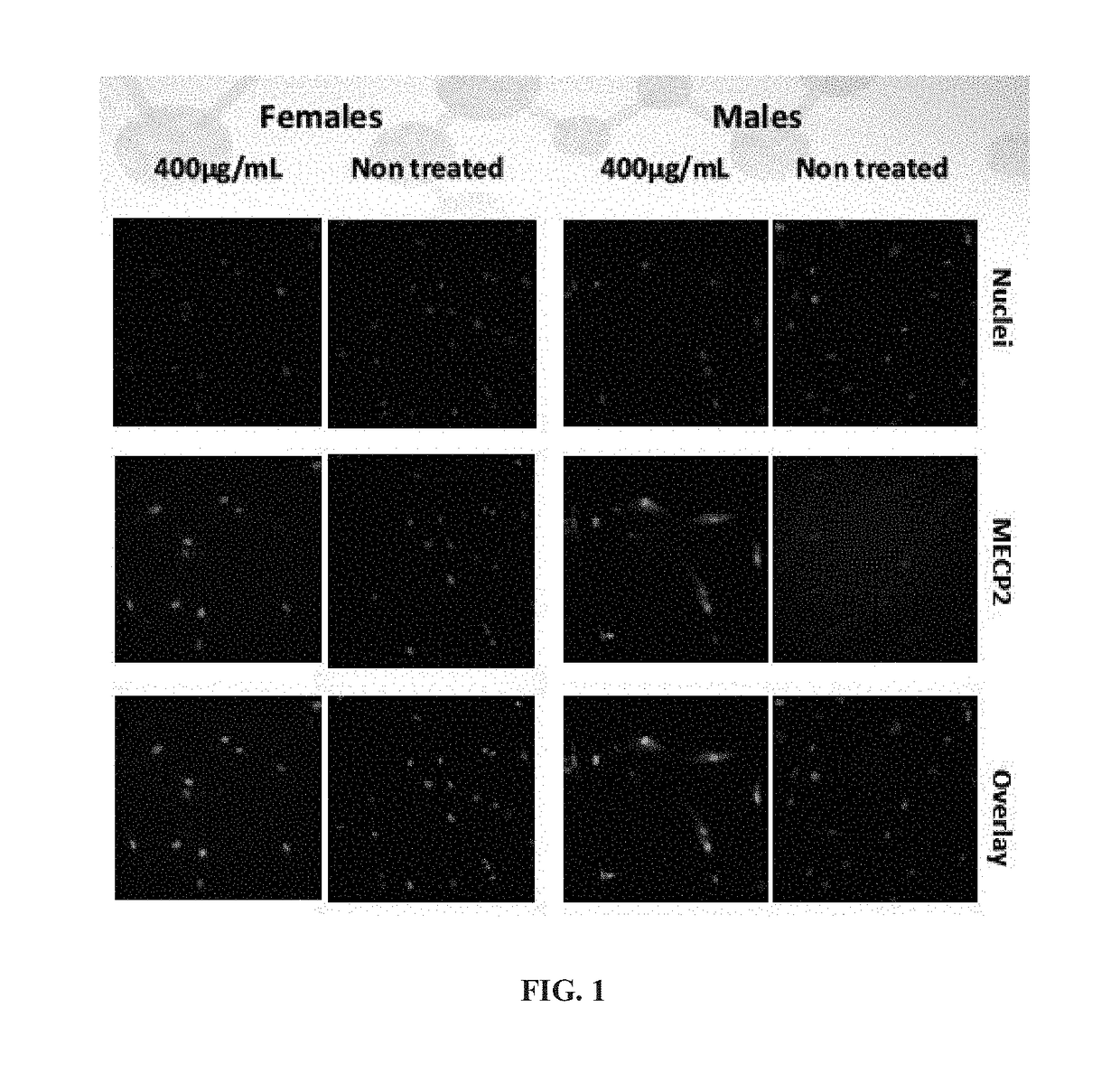 Use of aminoglycoside analogs in the treatment of rett syndrome