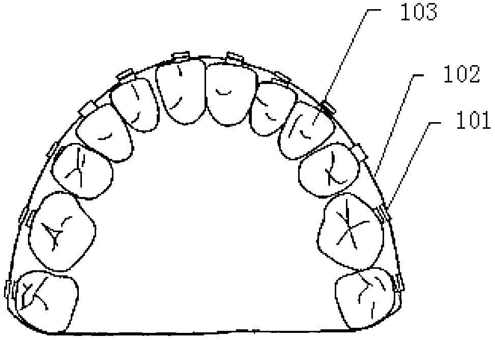 Orthodontic accelerator