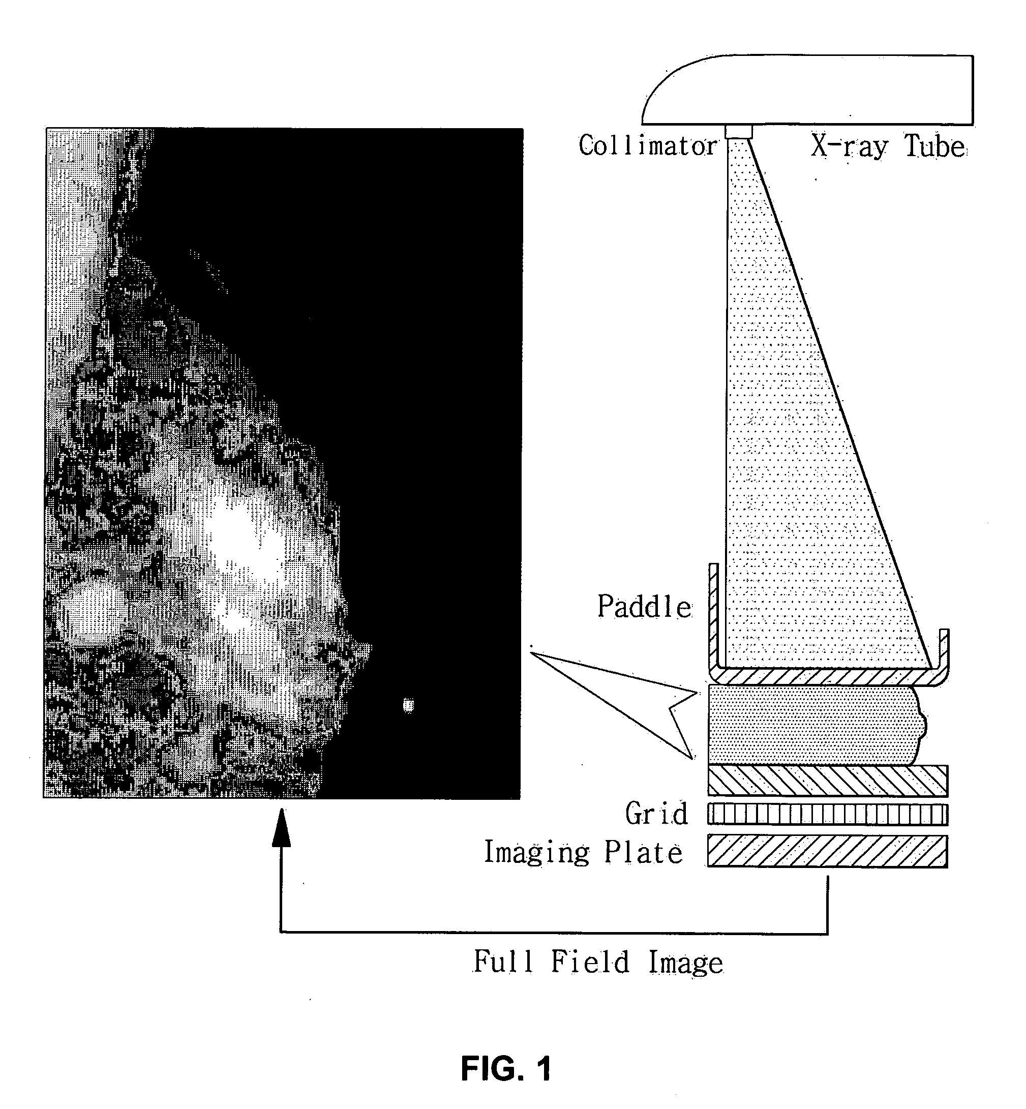 Dual-radiation type mammography apparatus and breast imaging method using the mammography apparatus