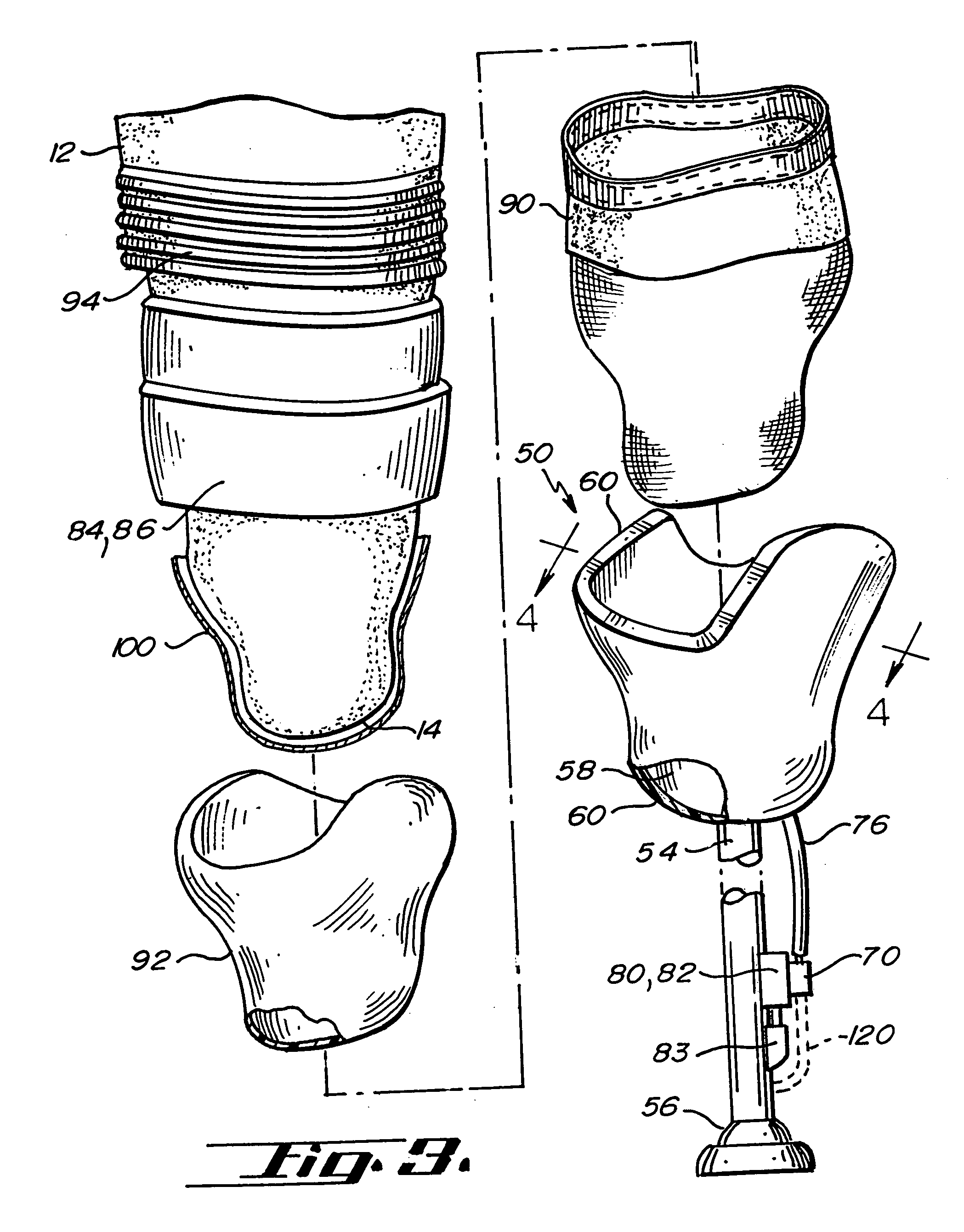 Osmotic membrane and vacuum system for artificial limb