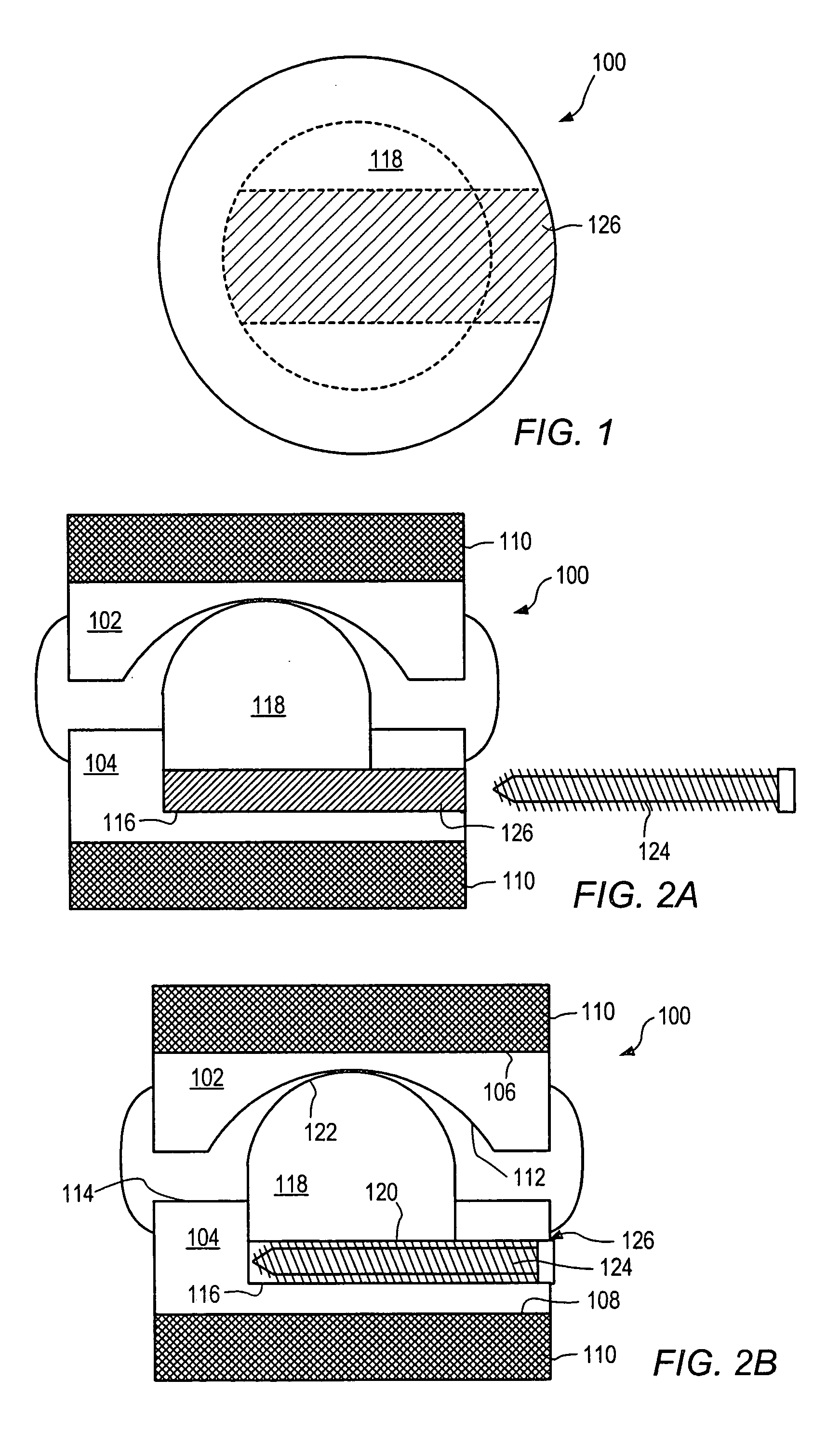 Expandable articulating intervertebral implant