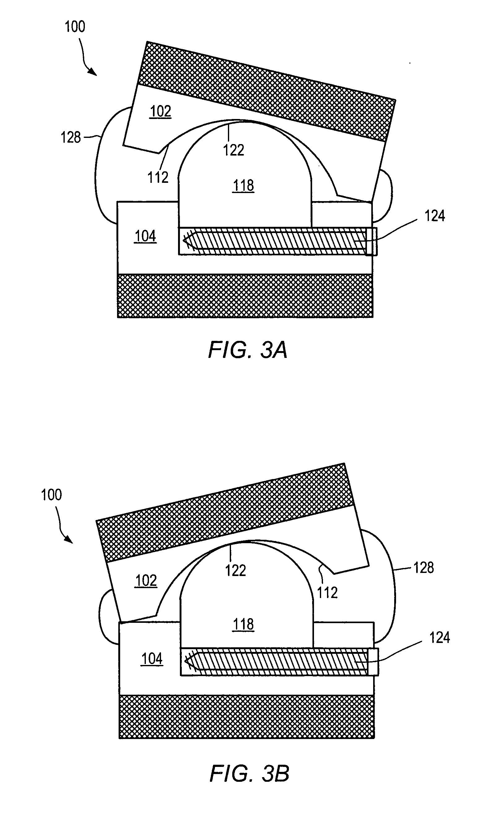 Expandable articulating intervertebral implant