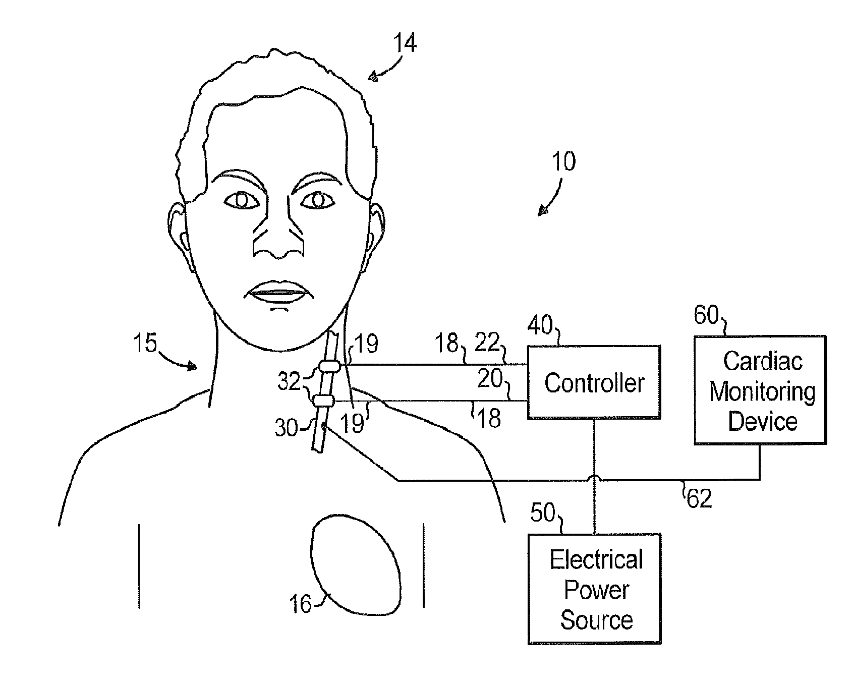 Cardiac defibrillation with vagus nerve stimulation