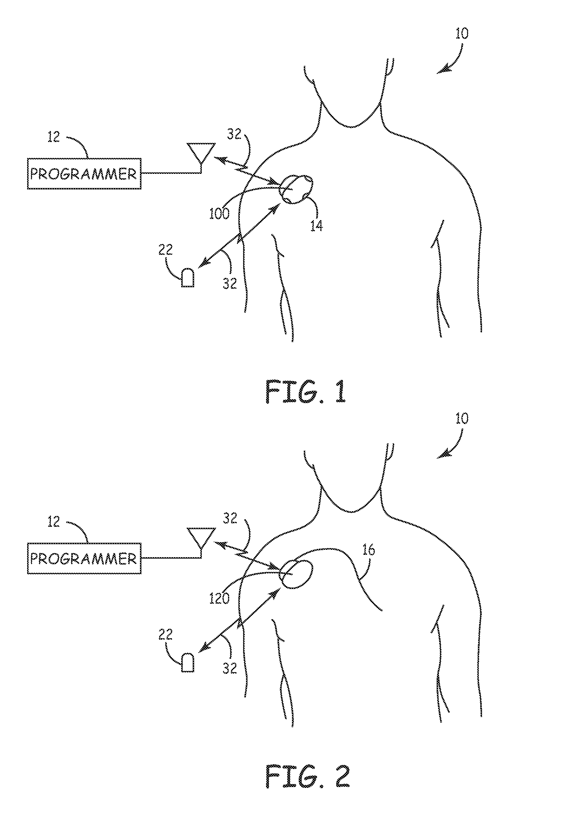 System and method for regulating cardiac triggered therapy to the brain