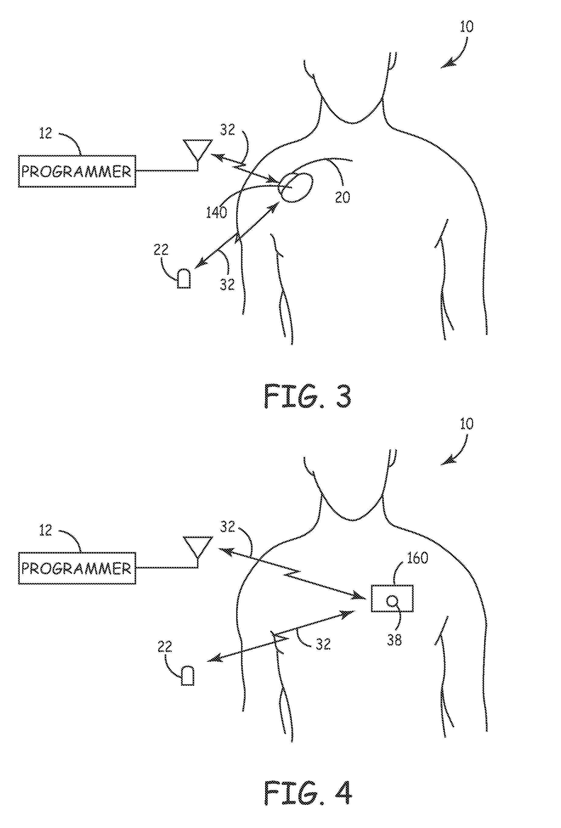 System and method for regulating cardiac triggered therapy to the brain