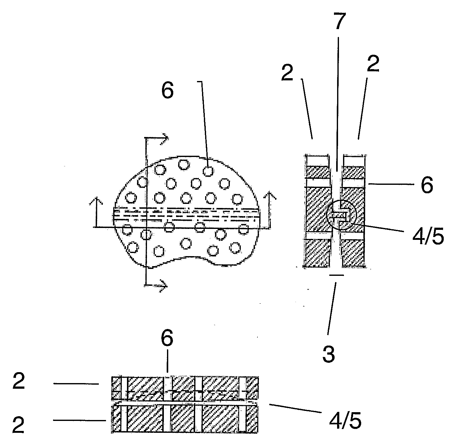 Disc Implant