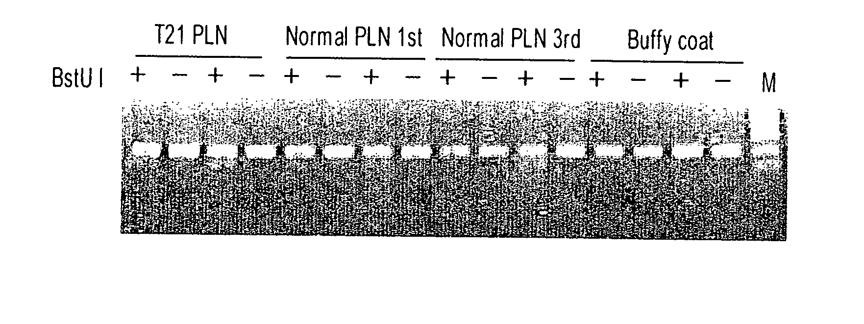 Novel markers for prenatal diagnosis and monitoring