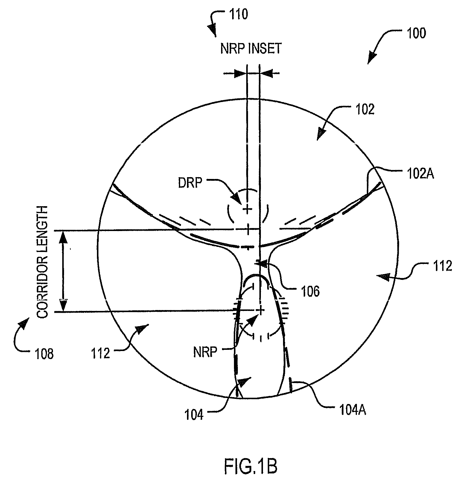 Array of progressive ophthalmic lens elements