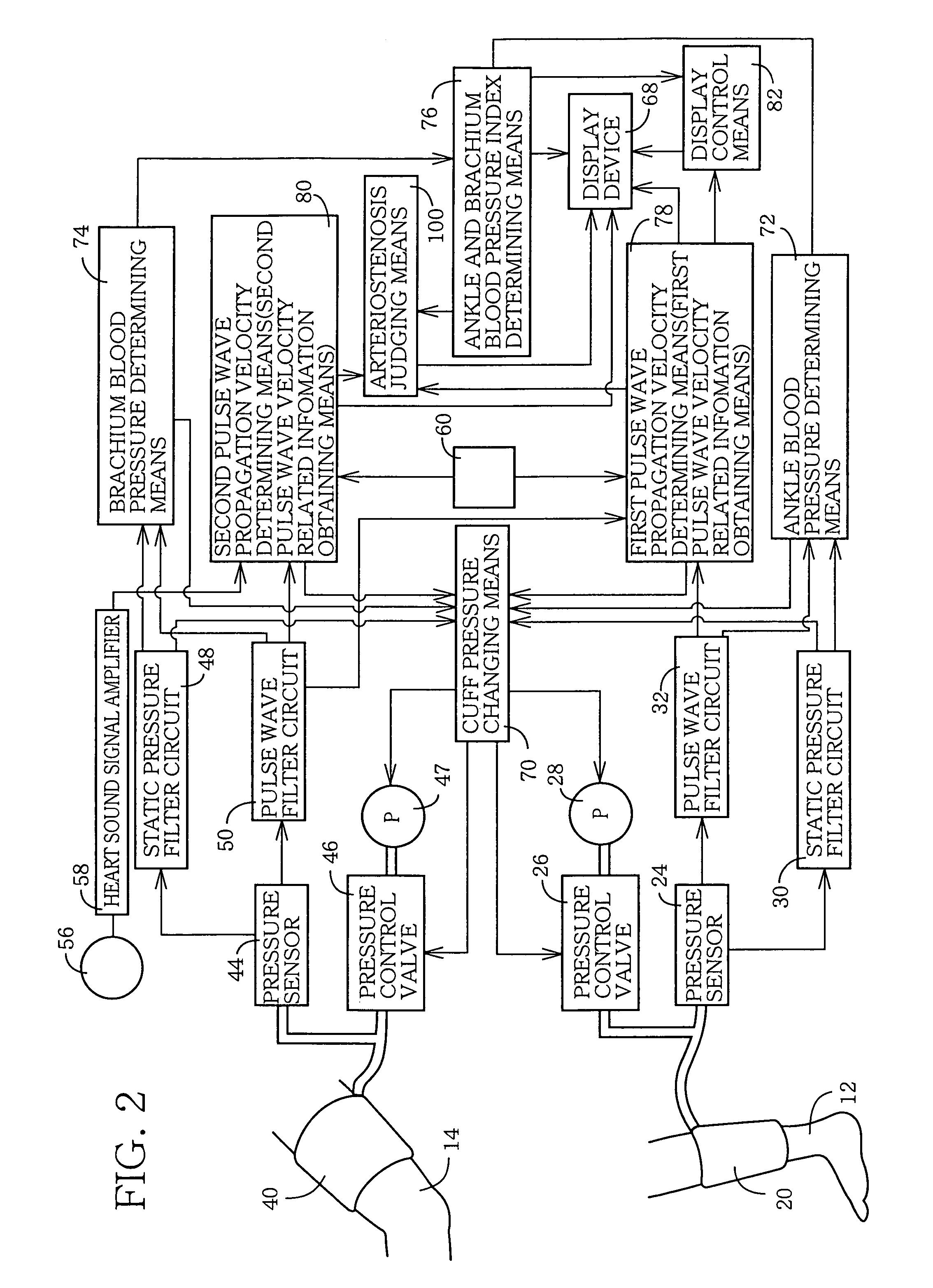 Arteriostenosis diagnosing apparatus