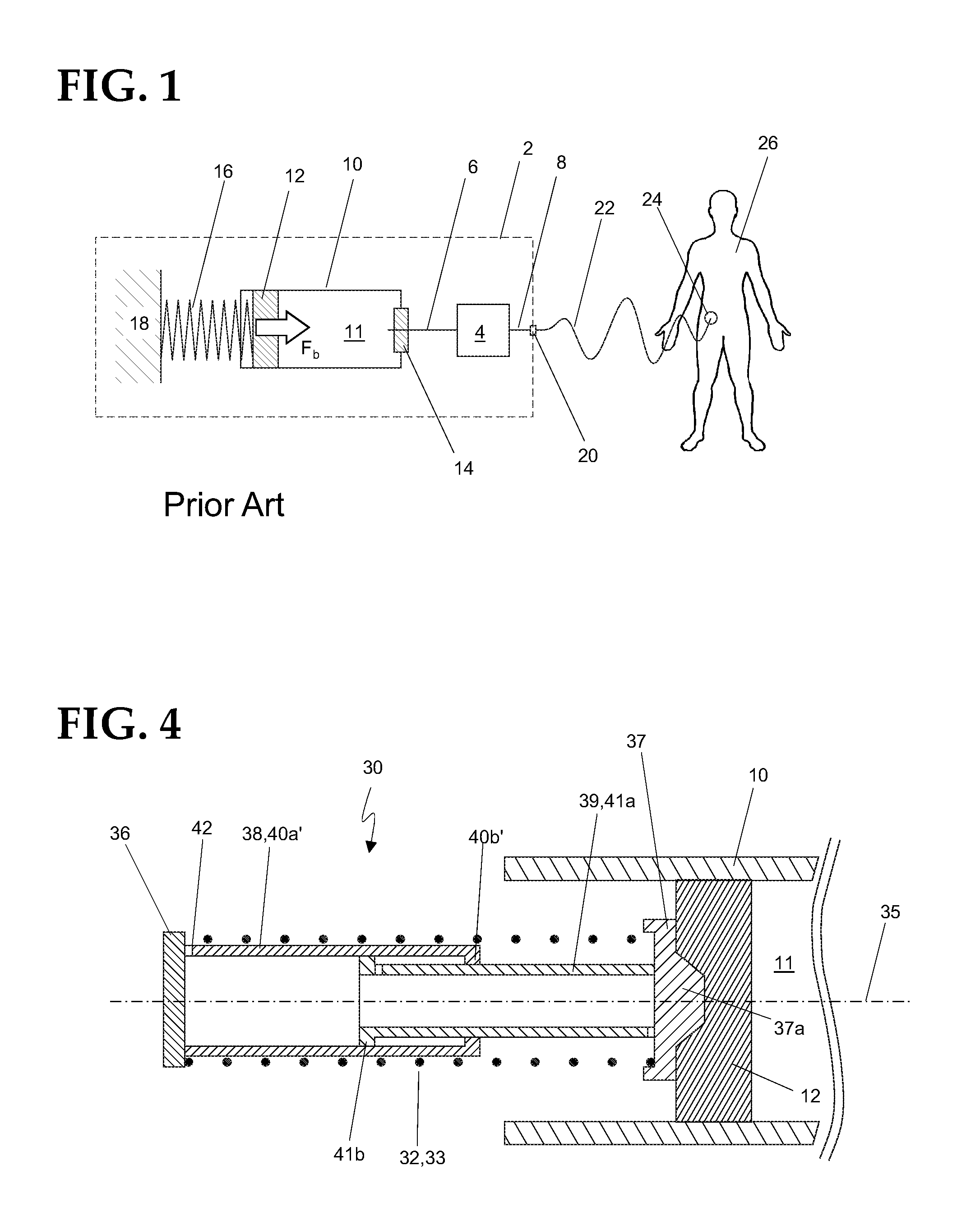 Spring force assembly for biasing or actuating stoppers of syringes, injection pen cartridges and the like