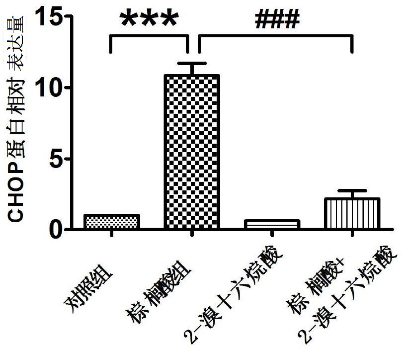 Medicine for preventing and treating metabolic syndrome induced by saturated fatty acid