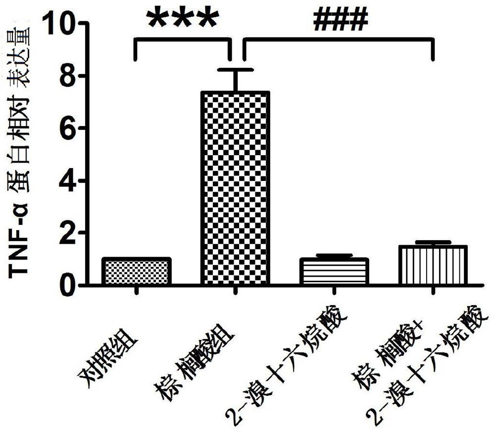 Medicine for preventing and treating metabolic syndrome induced by saturated fatty acid