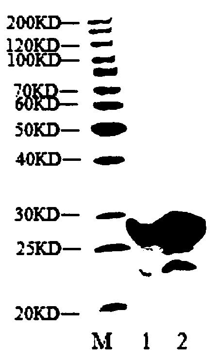 7 beta-HSDH enzyme and DPS fusion protein