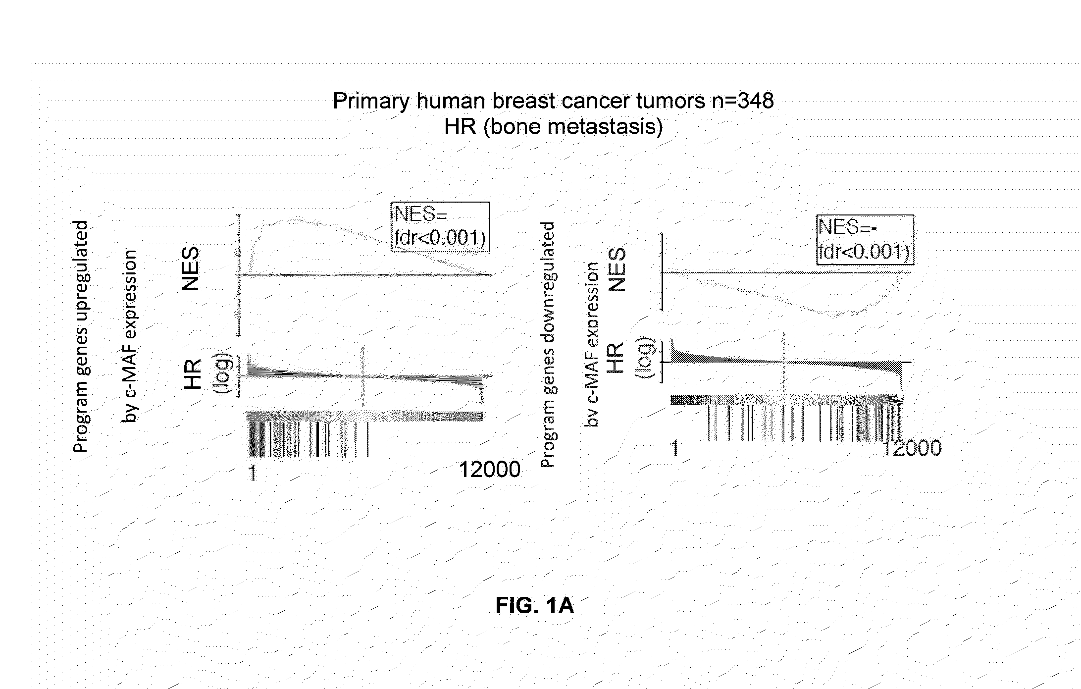 Method for the diagnosis, prognosis and treatment of cancer metastasis