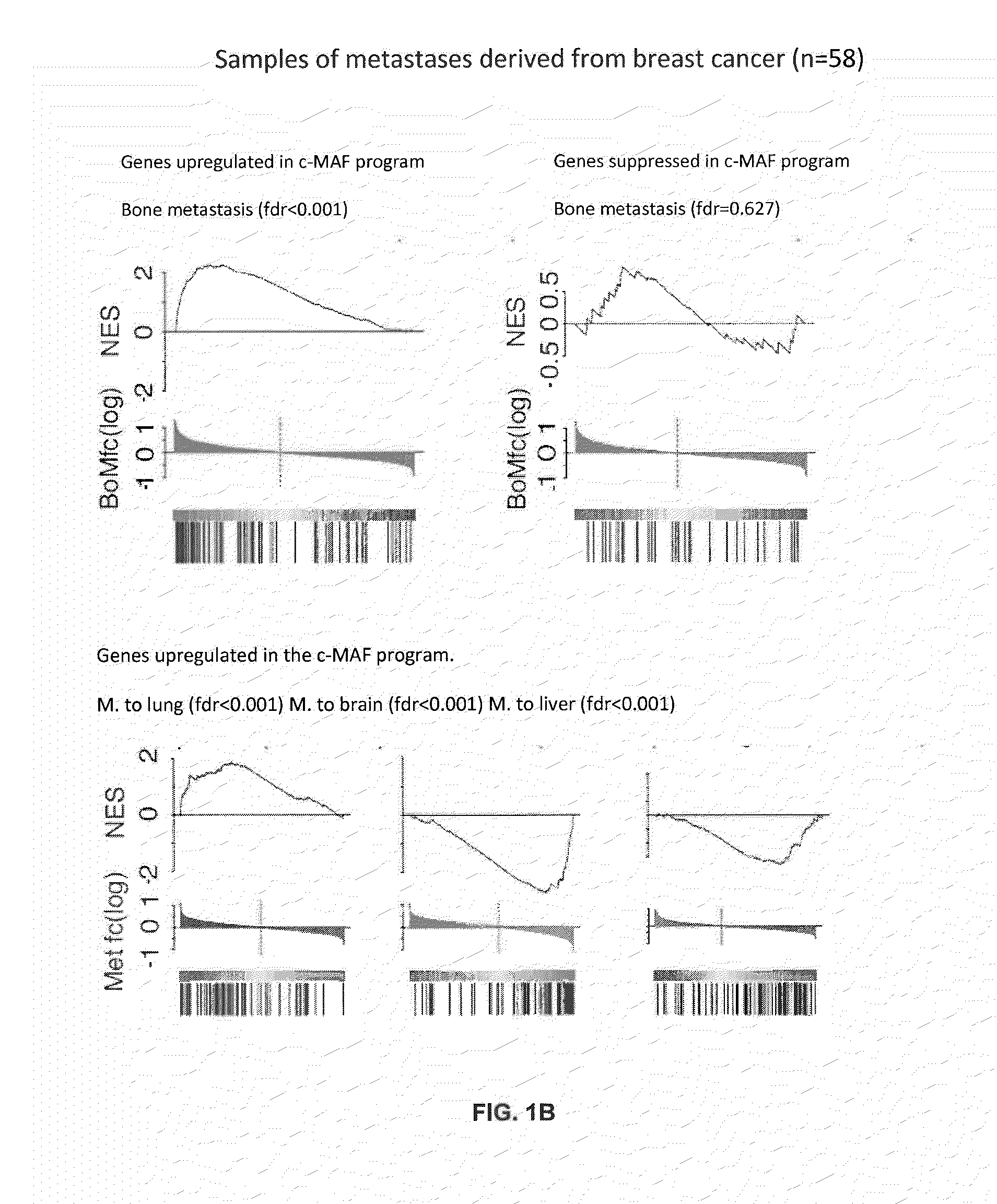 Method for the diagnosis, prognosis and treatment of cancer metastasis