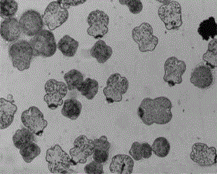 Application of harmine derivative to preparation of drugs for treating cystic echinococcosis