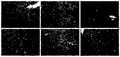 Bifidobacterium adolescentis and application thereof