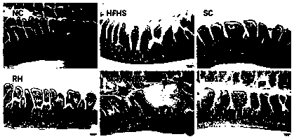 Bifidobacterium adolescentis and application thereof