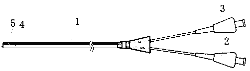 Intra-cavity closure system for varicose veins of lower extremities