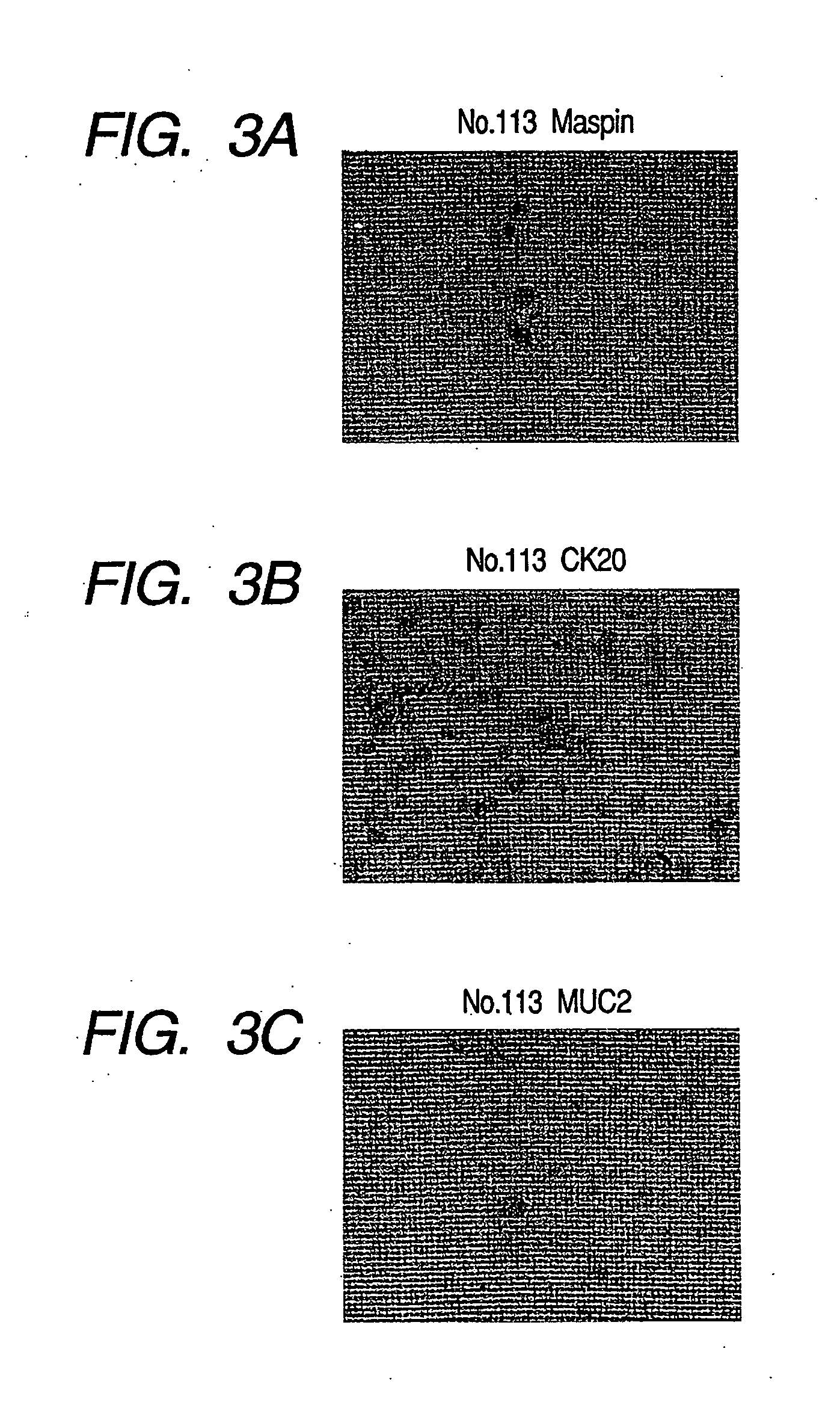 Probe, probe set and information acquisition method using the same