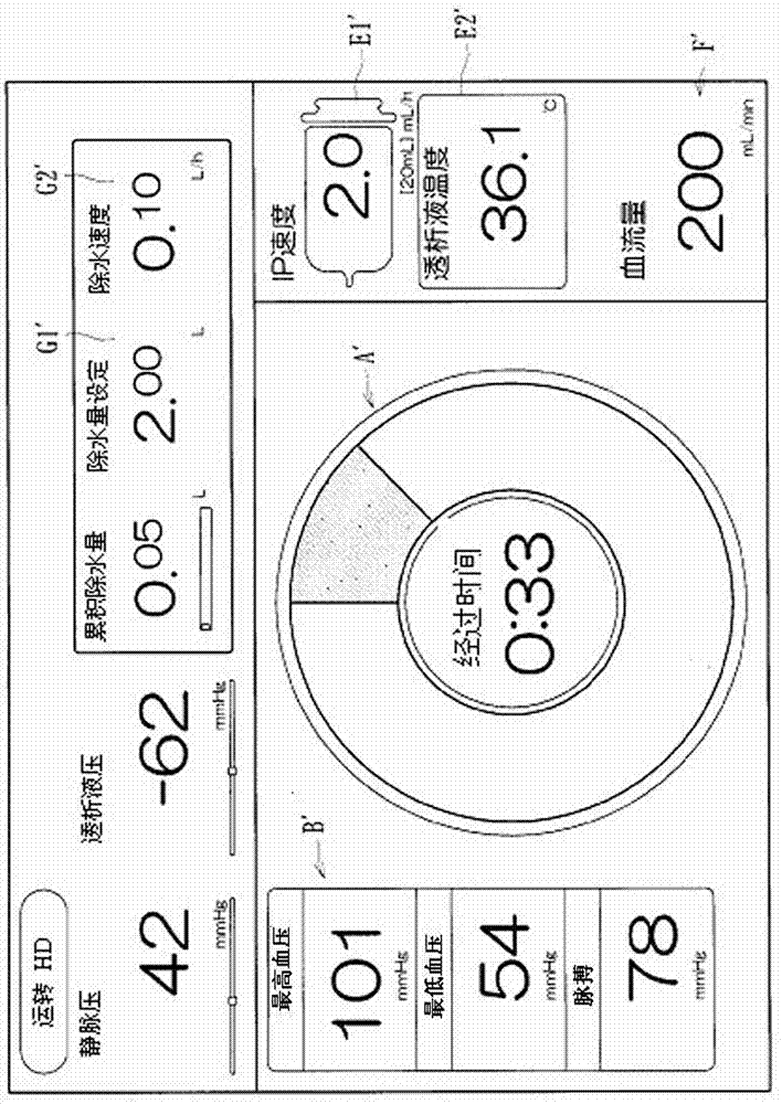 Blood purification device