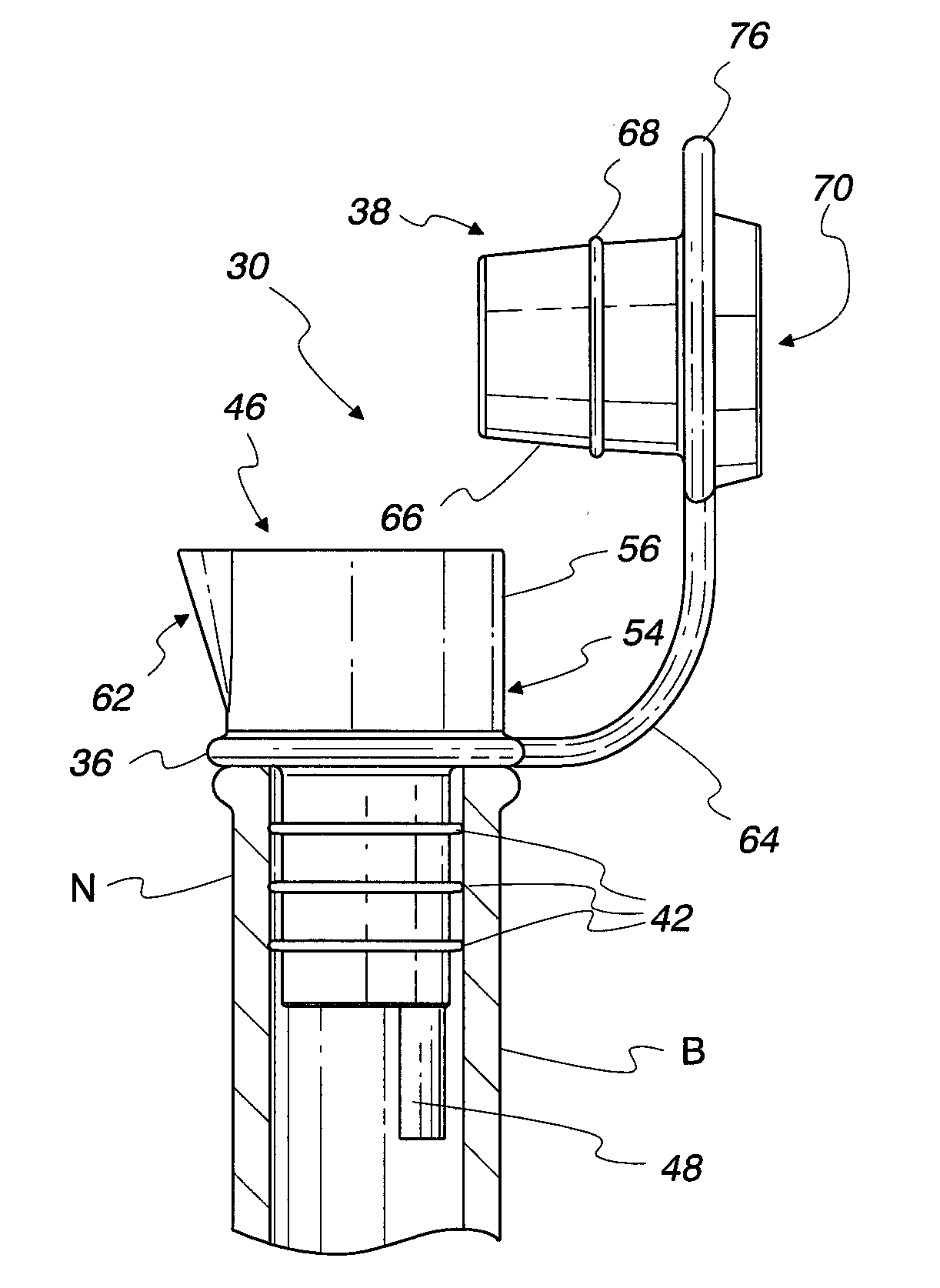 Vacuum bottle stopper for wine and method