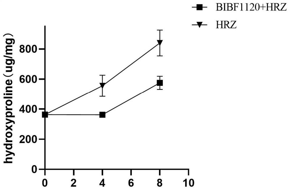 Application of medicine nintedanib for resisting idiopathic pulmonary fibrosis in tuberculosis treatment