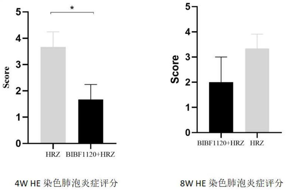 Application of medicine nintedanib for resisting idiopathic pulmonary fibrosis in tuberculosis treatment