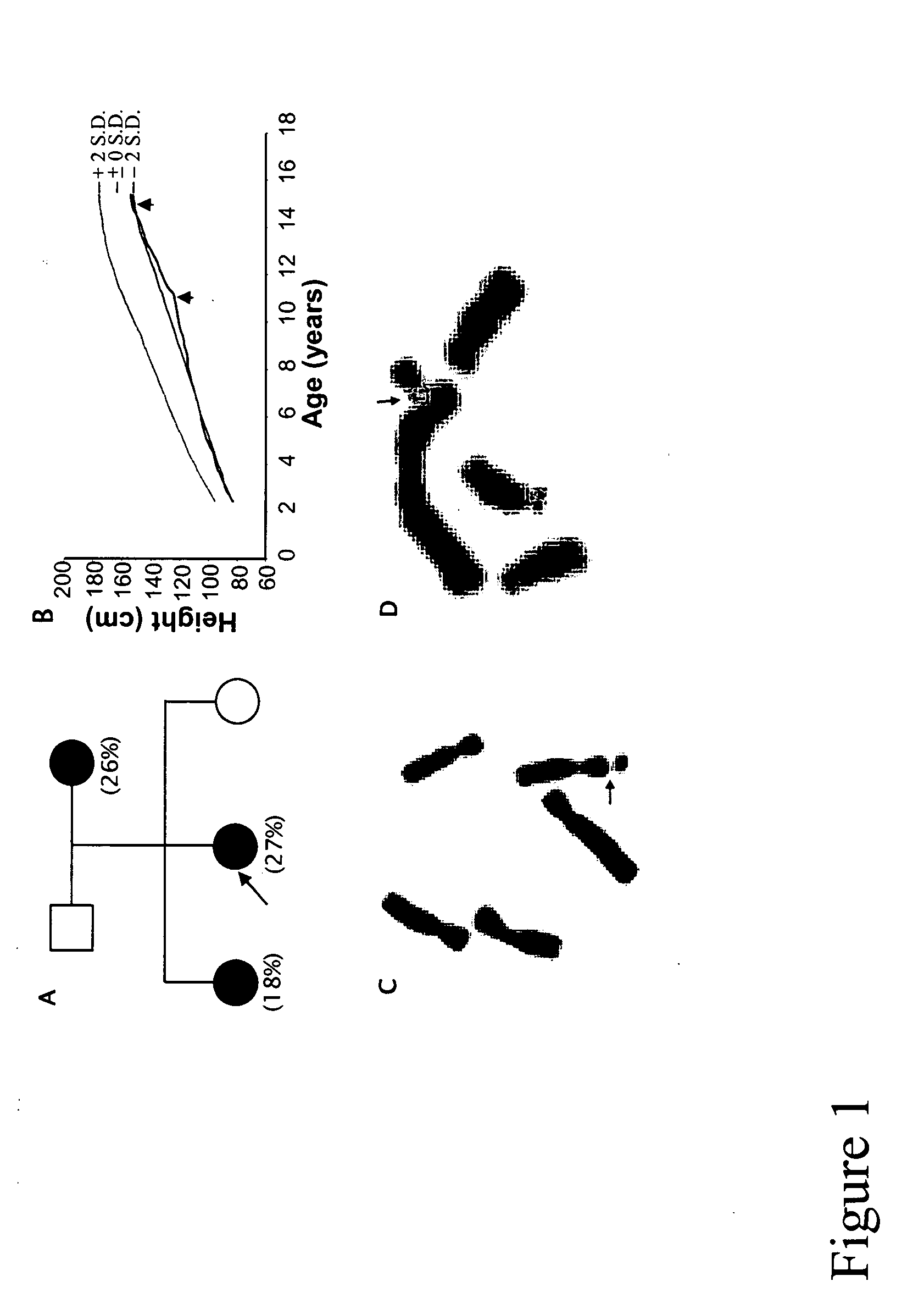 Methods and reagents for predicting the likelihood of developing short stature caused by FRAXG