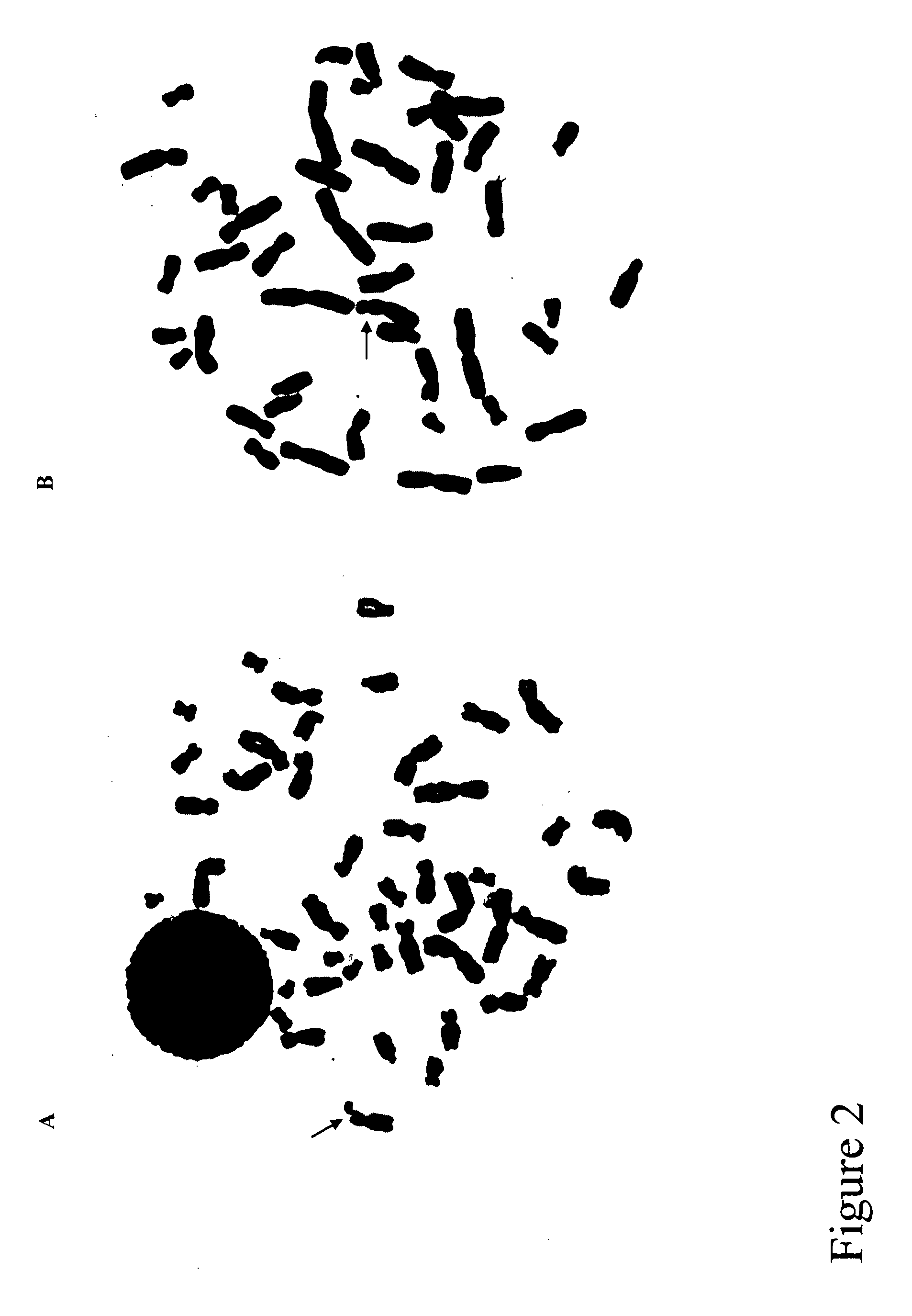 Methods and reagents for predicting the likelihood of developing short stature caused by FRAXG