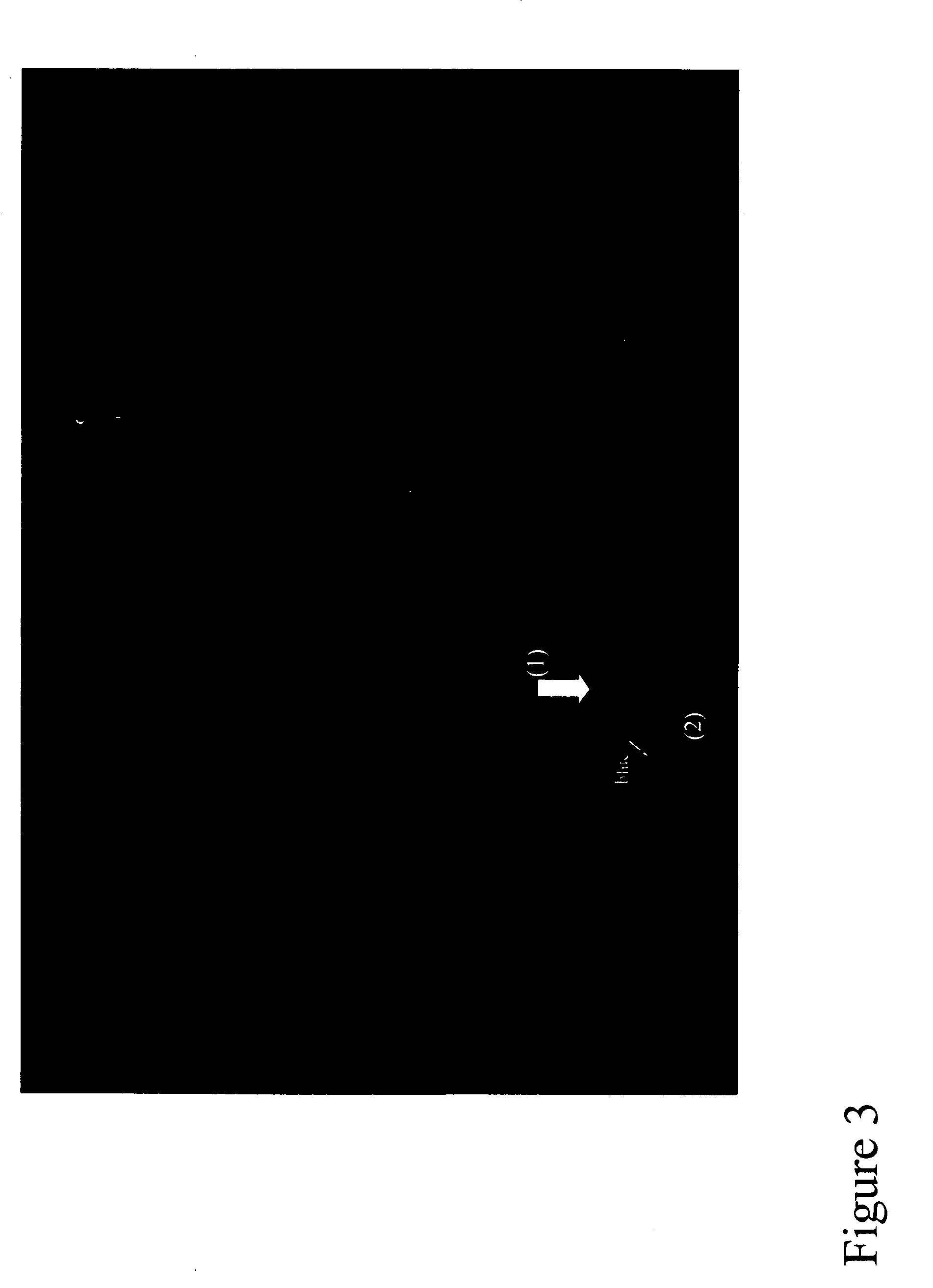 Methods and reagents for predicting the likelihood of developing short stature caused by FRAXG