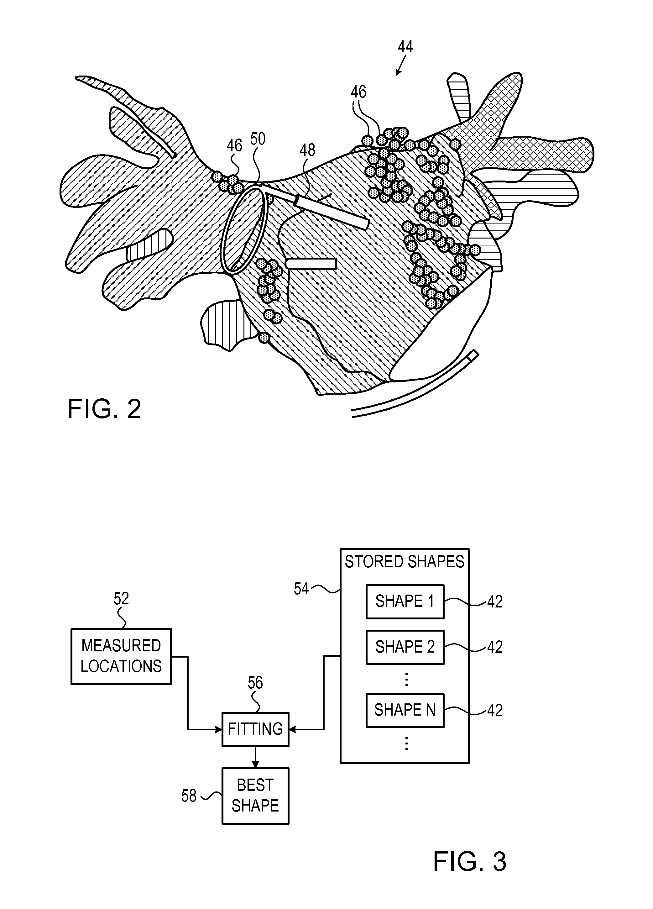 Model based reconstruction of the heart from sparse samples