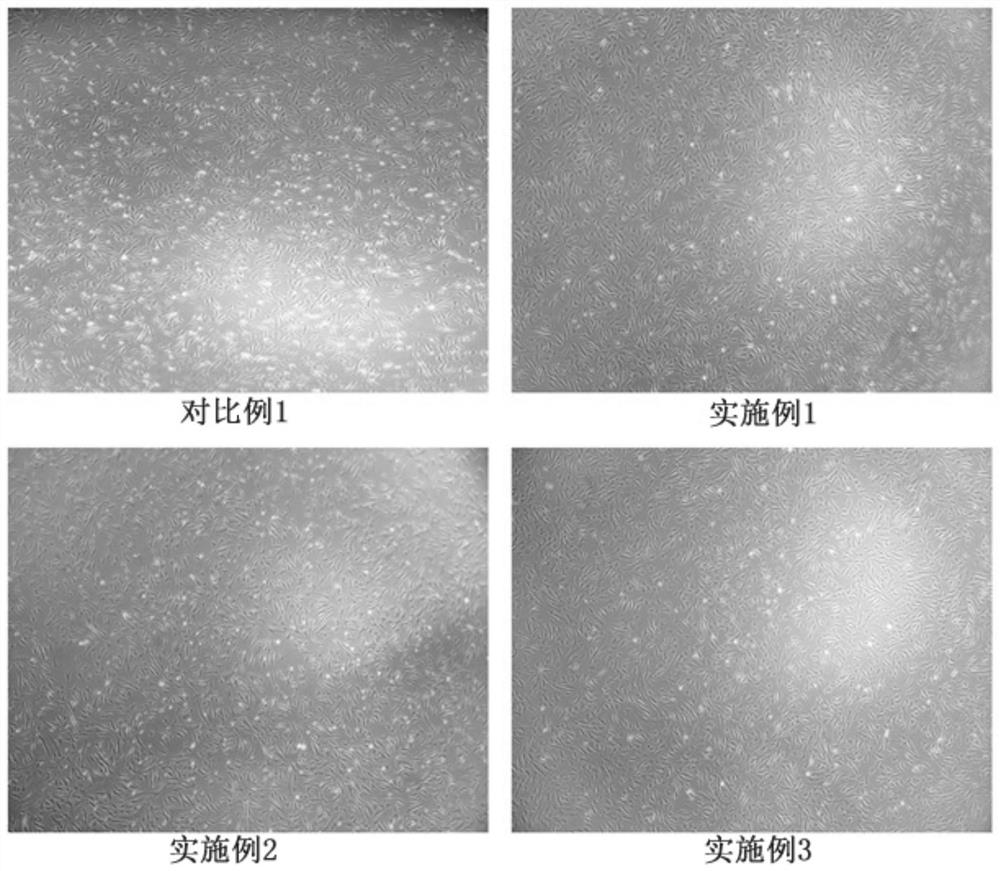 A kind of stem cell cryopreservation liquid and its preparation method and cryopreservation method