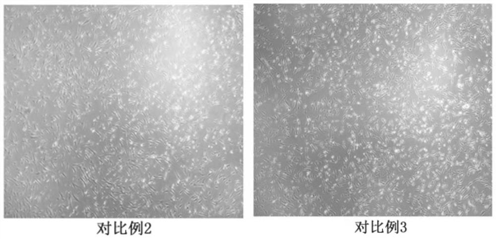 A kind of stem cell cryopreservation liquid and its preparation method and cryopreservation method