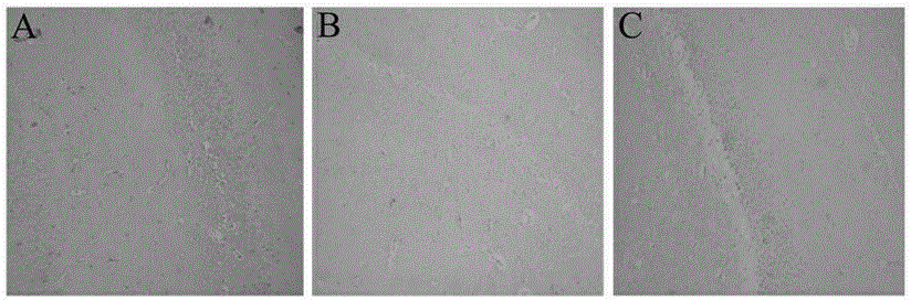 Application of non-steroidal anti-inflammatory medicines in preparation of medicine for preventing and treating diabetic encephalopathy