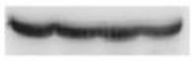 Application of exosome in preparing medicine for treating interstitial lung injury and/or pulmonary fibrosis