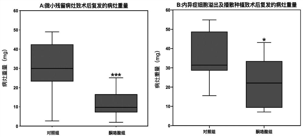 Application of ketorolac to preparation of medicine for preventing or treating postoperative recurrence of endometriosis