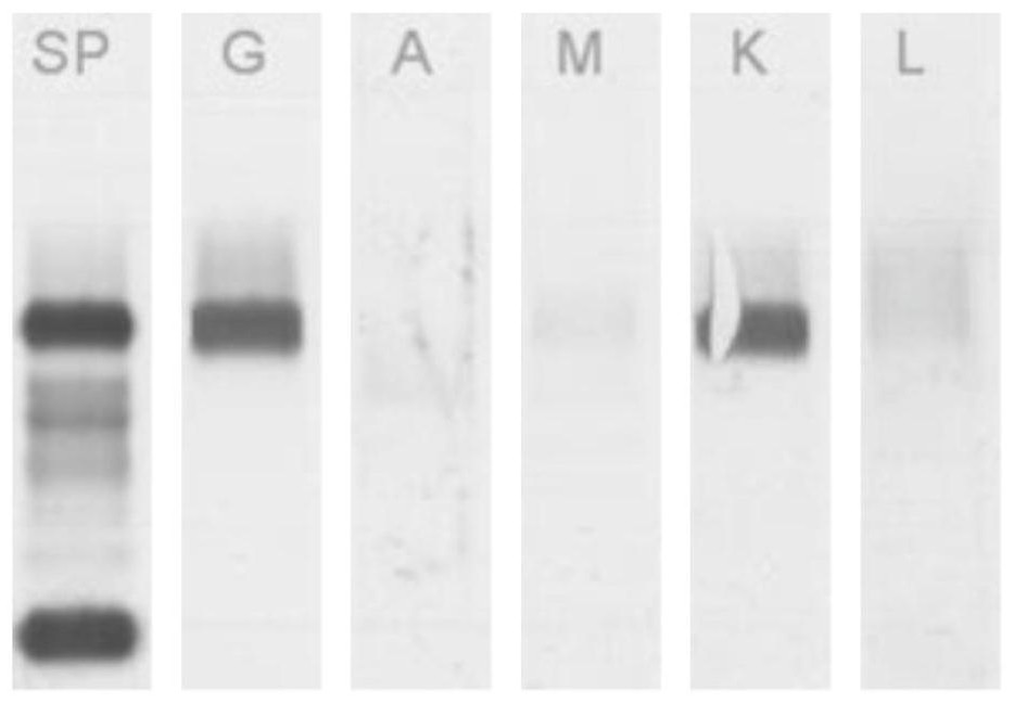 A method for automatic classification of immunofixation electropherograms based on their extracted features