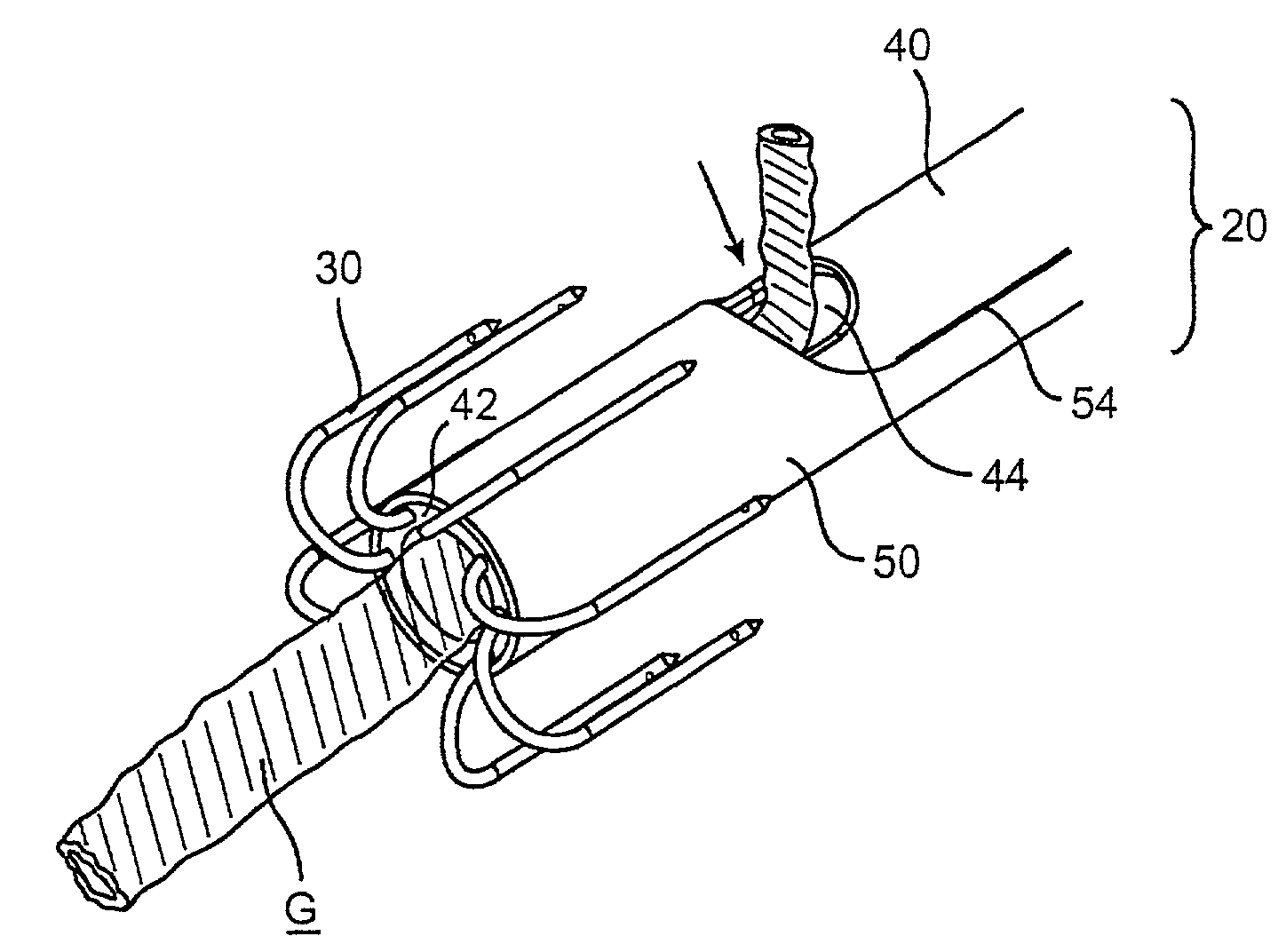 Device and method for performing end-to-side anastomosis